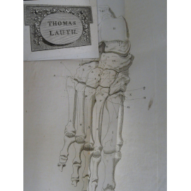 Lisfranc de Saint Martin Nouvelle Méthode opératoire pour l'Amputation partielle du pied Belles provenances. rare et précieux.
