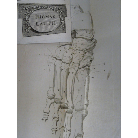 Lisfranc de Saint Martin Nouvelle Méthode opératoire pour l'Amputation partielle du pied Belles provenances. rare et précieux.