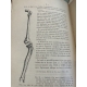 Médecine Alexandre Guillemain Osteo arthrite tuberculeuse du genou de l'enfant. Steinheil 1893