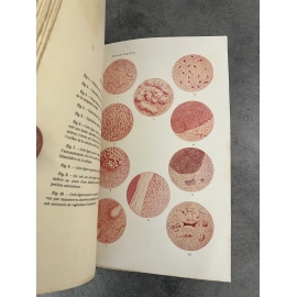 Médecine Charles David L'endoscopie utérine hystéroscopie Jacques 1908 1 planche couleur