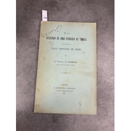 Médecine Canniot Résection du bord inférieur du thorax pour aborder la face convexe du foie Steinheil 1891